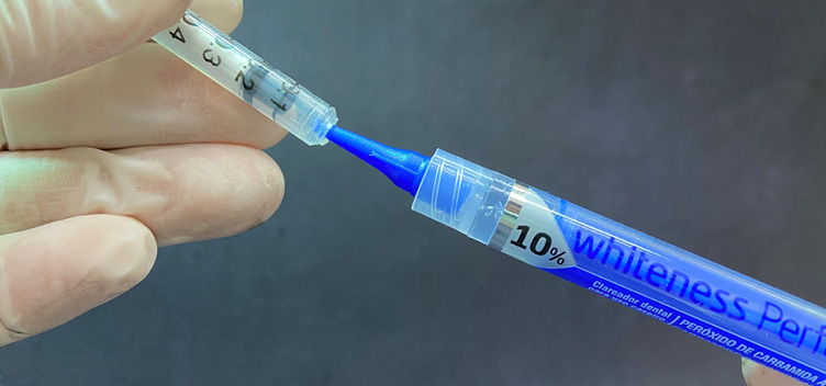 De acordo com o estudo, o gel clareador à base de Peróxido de Carbamida a 10% é o tratamento mais seguro e eficaz. #ParaTodosVerem: Fotografia mostra, em fundo escuro, a ponta de um gel clareador enfiada em uma ferramenta cilíndrica, transparente. No lado esquerdo da imagem, uma mão, vestida com uma luva, segura a ferramenta cilíndrica, transparente.